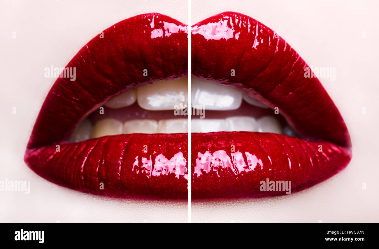 Passionate red lips. Teeth whitening before and after. Macro photography, small depth of field Stock Photo