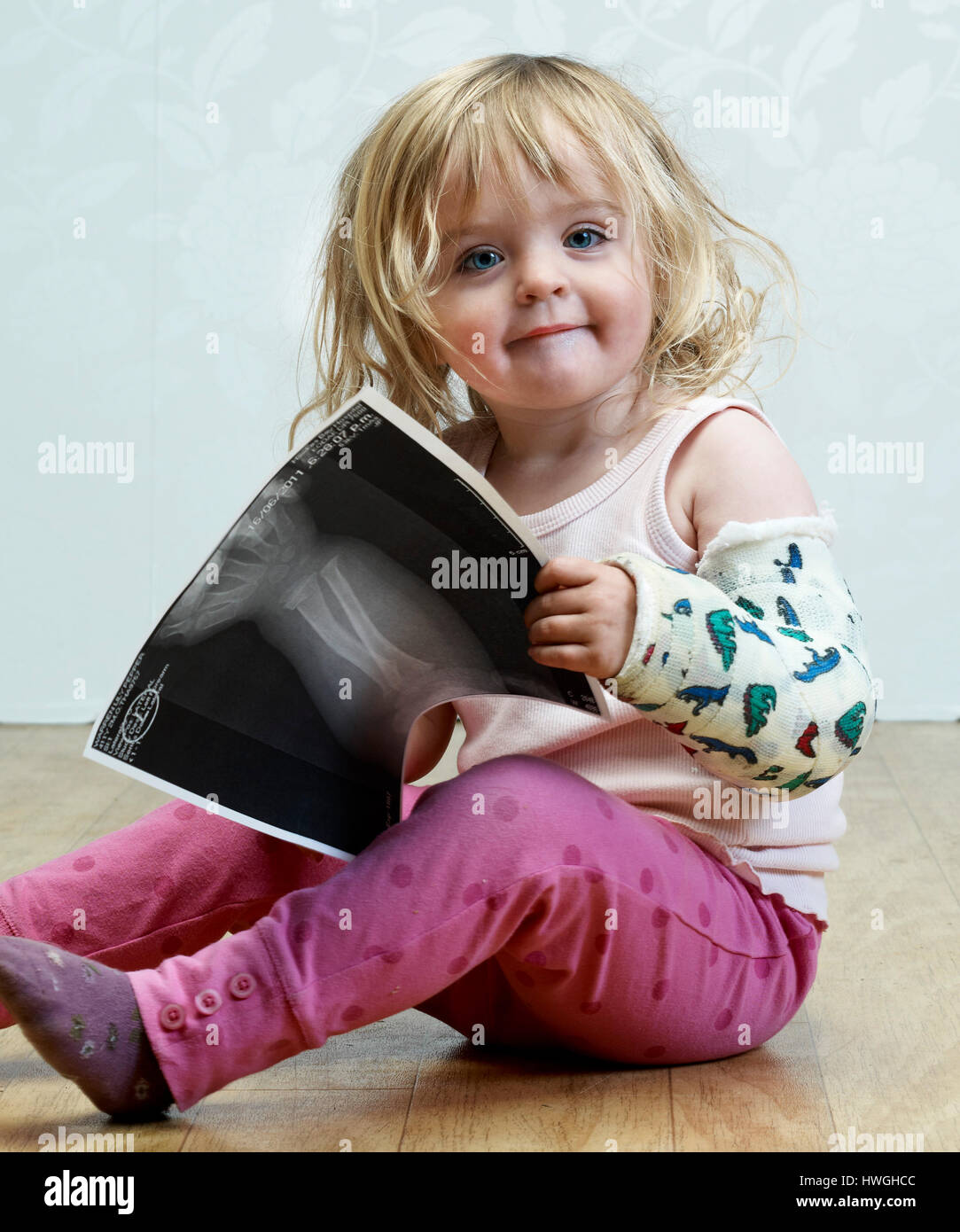 child holding X ray with broken arm in cast Stock Photo Alamy