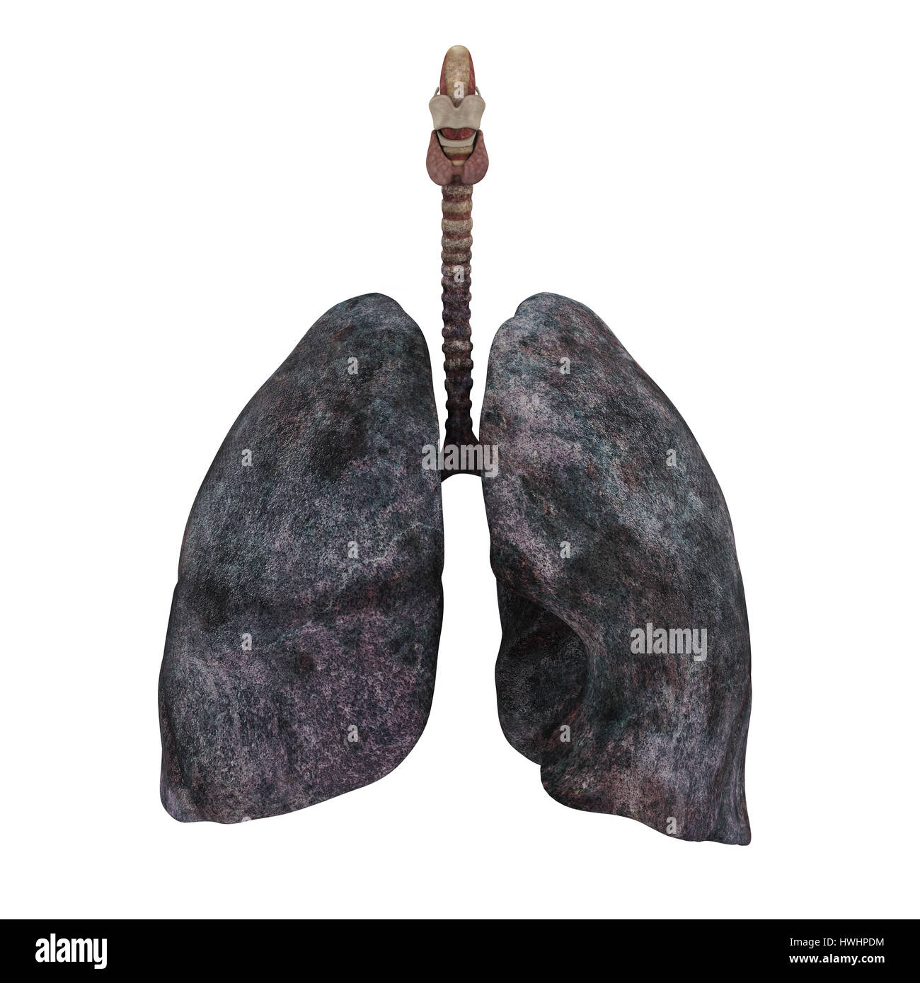 Smokers Lung Illustration Isolated Stock Photo