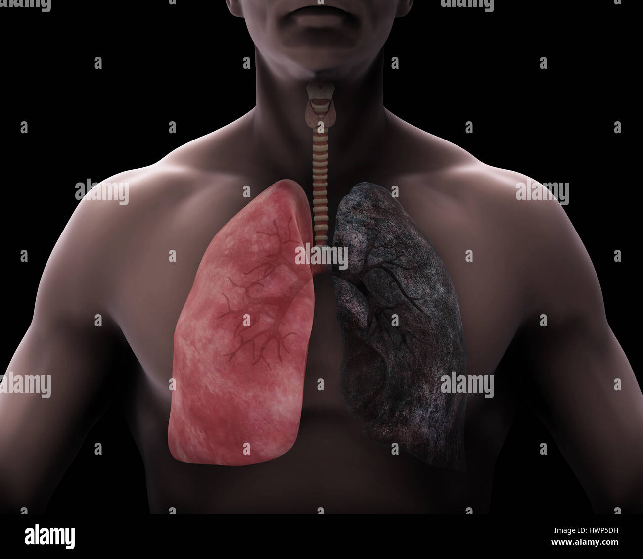 Healthy Lung and Smokers Lung Stock Photo