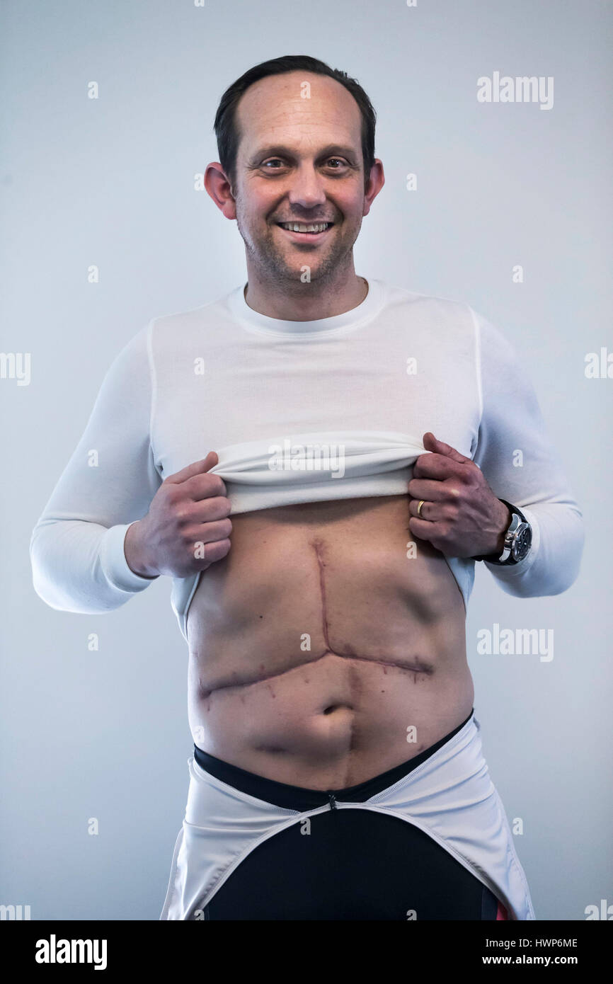 Operation or surgical team hires stock photography and images Alamy