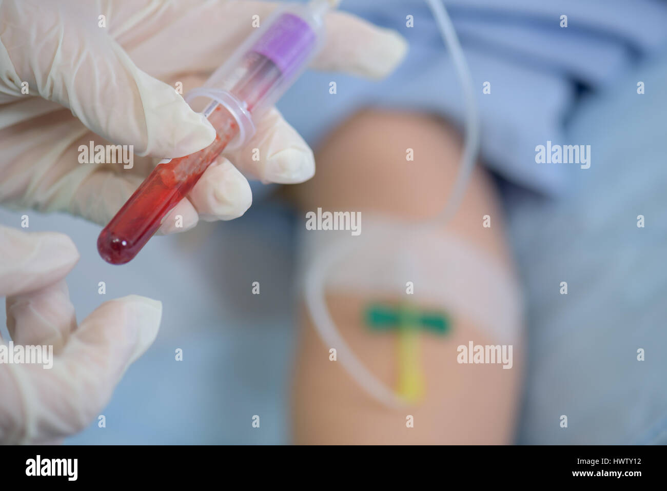 Closeup of test tube of blood from patient's arm Stock Photo