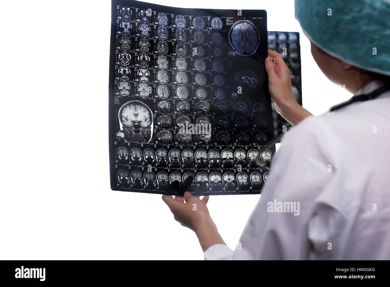 Doctor holding a picture of a brain MRI Stock Photo - Alamy