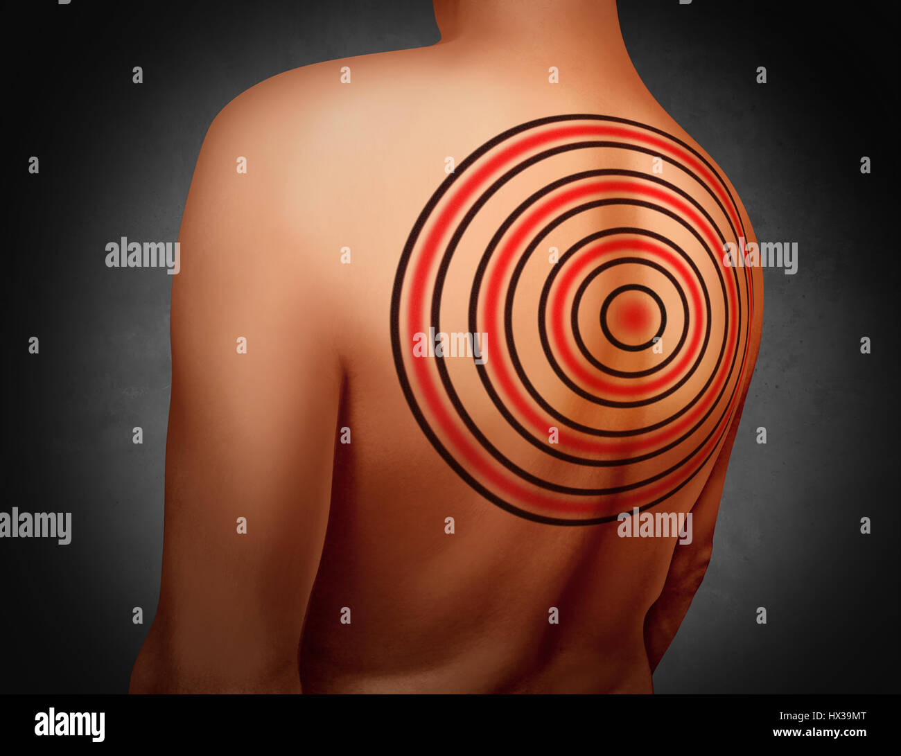 Target on your back metaphor as a person with a tattoo of a bulls eye symbol tattooed on the skin as an icon for being a victim of bullying. Stock Photo