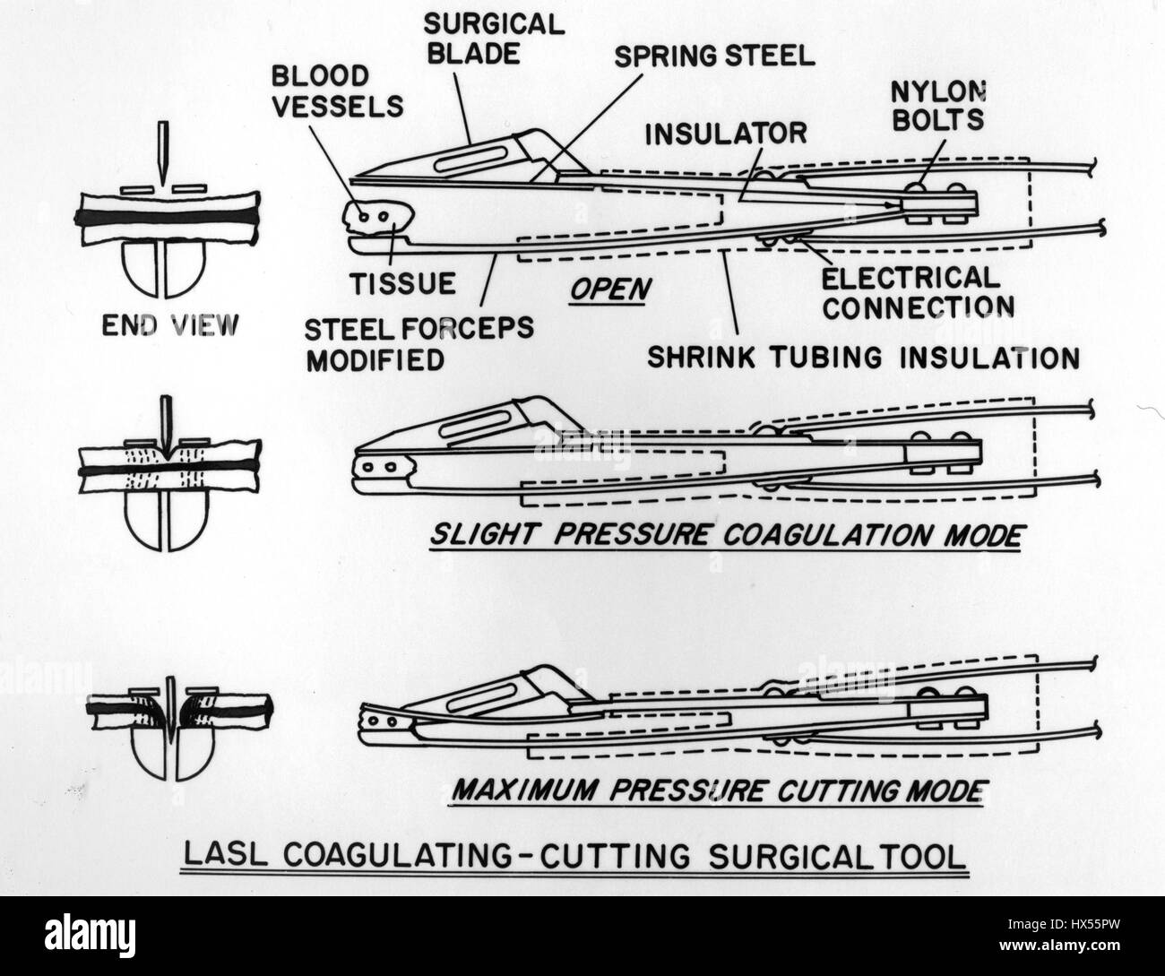 Diagram showing the different ways to use a LASL coagulating-cutting surgical tool, depending on desired pressure, 2014. Image courtesy US Department of Energy. Stock Photo
