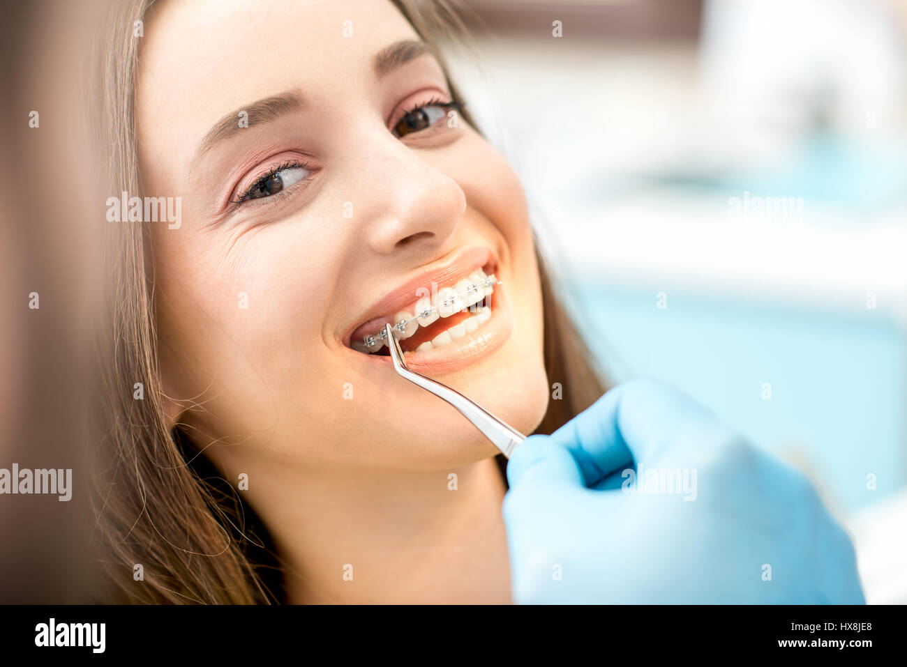 Putting dental braces to the woman's teeth at the dental office Stock