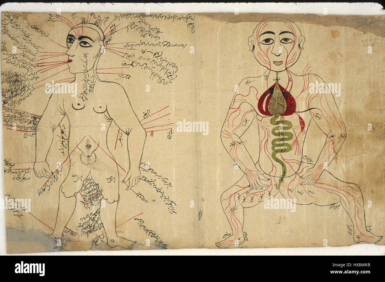 This 16th-century painting illustrates a bloodletting procedure as ...