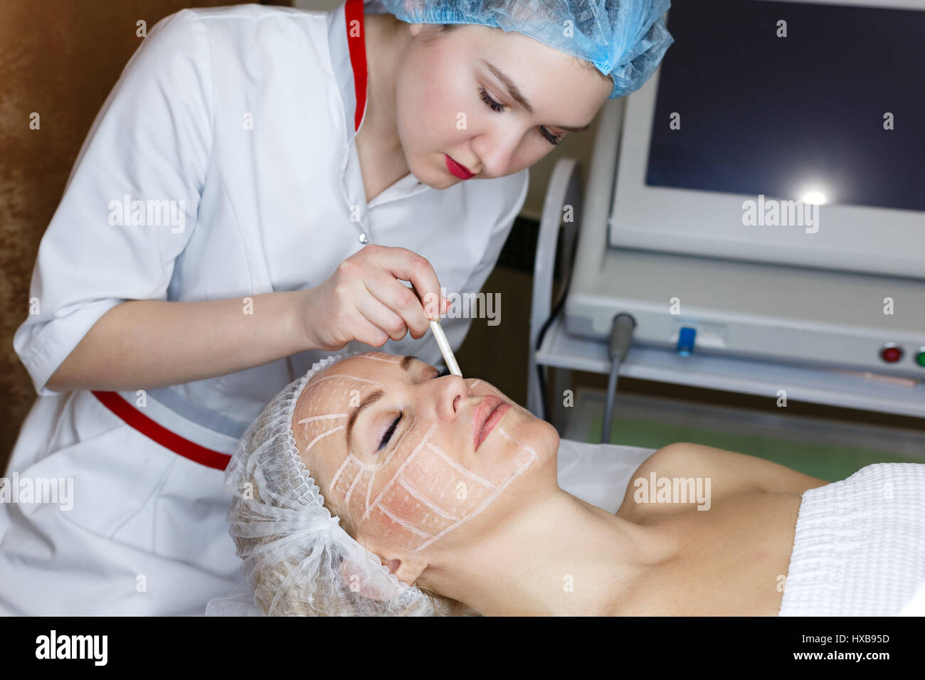 Nonsurgical face lifting. SMAS lifting ultrasonic. Facelift. The