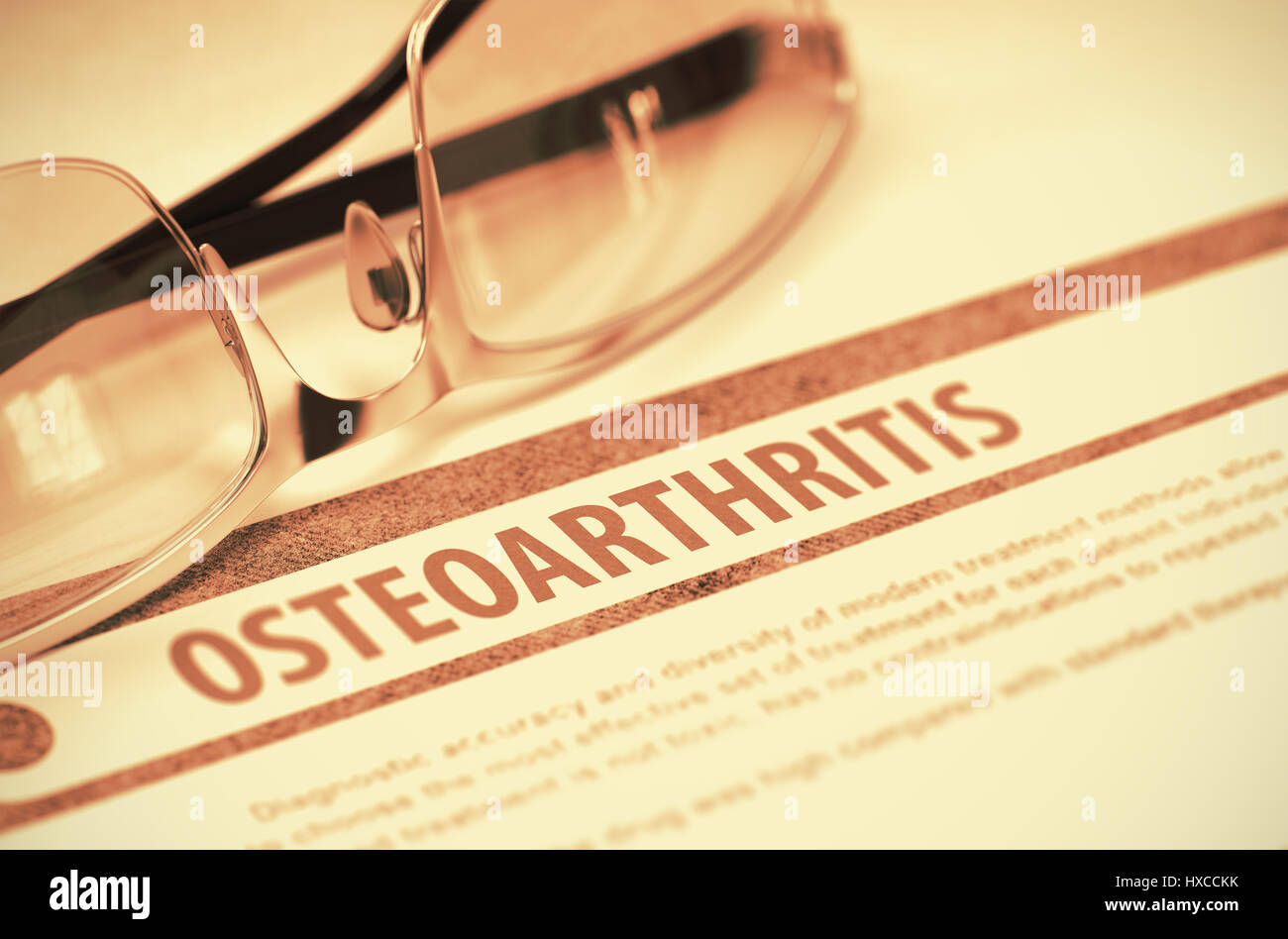 Osteoarthritis Medicine 3d Illustration Stock Photo Alamy