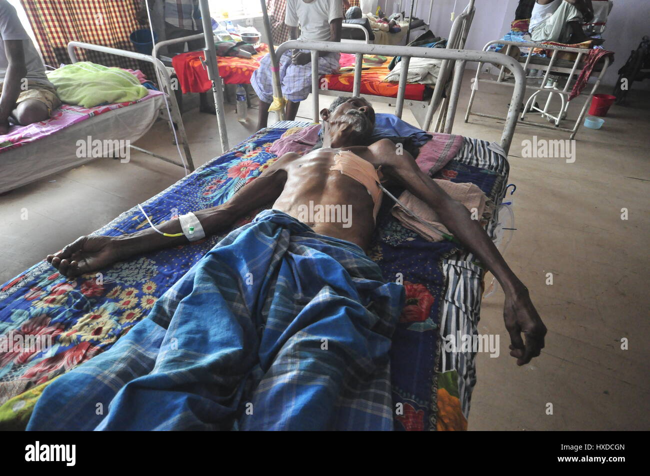 An Indian TB patient -  24/03/2017  -  India / Tripura / Agartala  -  INDIA,TRIPURA-:An Indian TB patient is struggling hard in a hospital in Agartala capital of the North Eastern state of Tripura,  WHO is calling for new commitments and new action in the global fight against tuberculosis 'one of the world's top infectious killers.                                                                                       0n 24th march , whole world is celebrates  World TB Day.This years theme is  Unite to End TB: Leave no one behind.2017 is the second year of a two-year 'Unite to End TB' campaign f Stock Photo