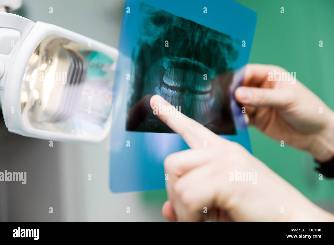 Dentist analyzing xray of teeth Stock Photo Alamy