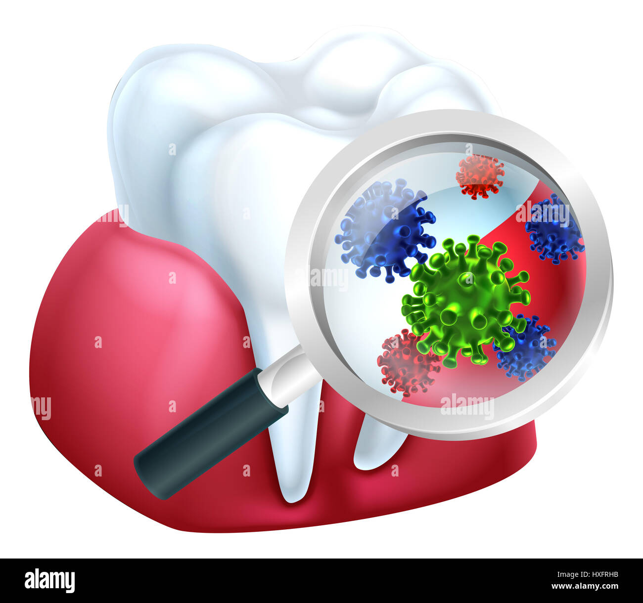 A medical dental illustration of bacteria on a tooth and gum being magnified Stock Photo
