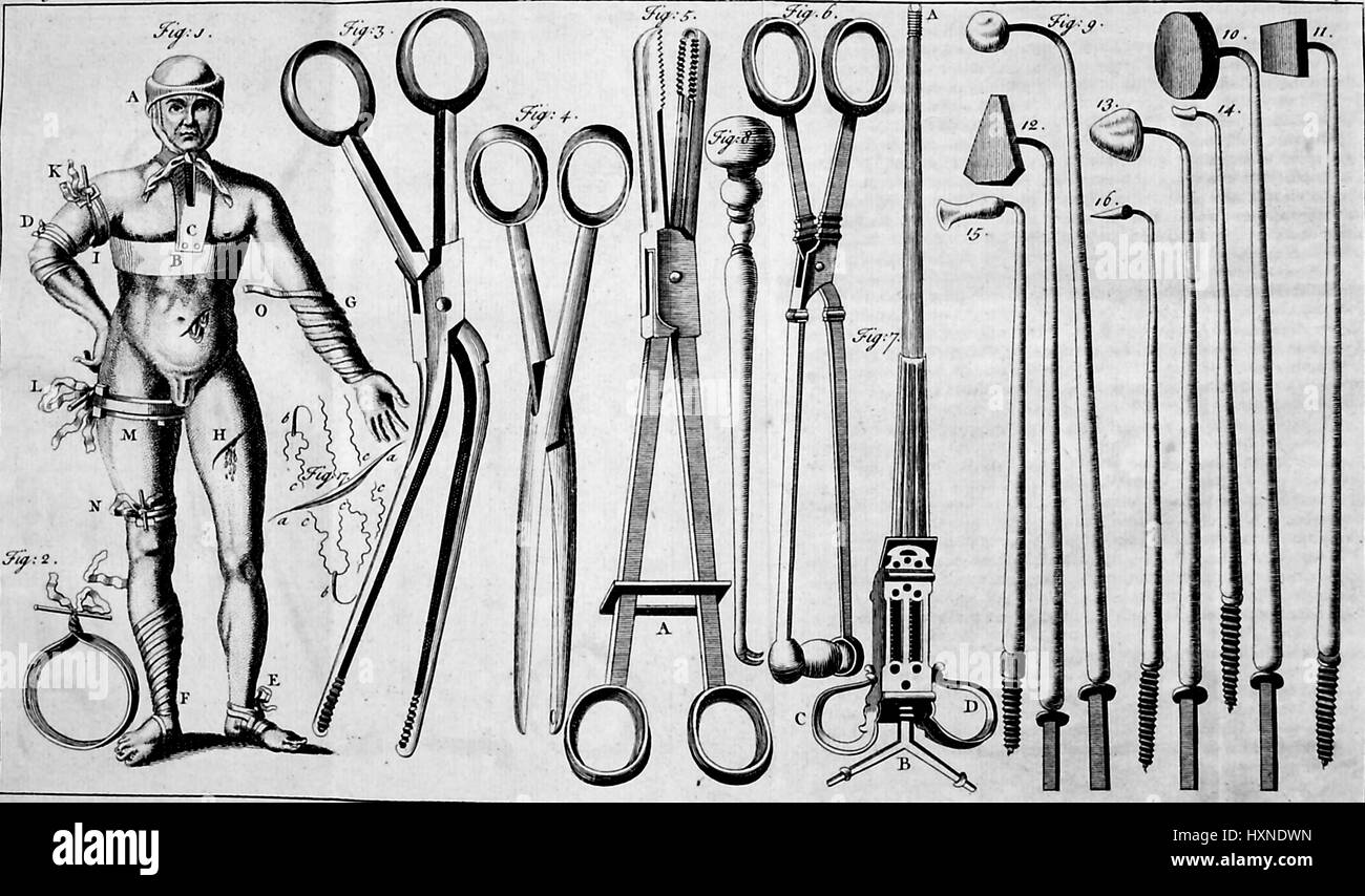 Medical illustration depicting various surgical implements, as well as an illustration of a human figure standing at ease, with various parts of his skin removed to reveal different surgical incisions, wrappings and pieces of medical equipment, 1825. Stock Photo