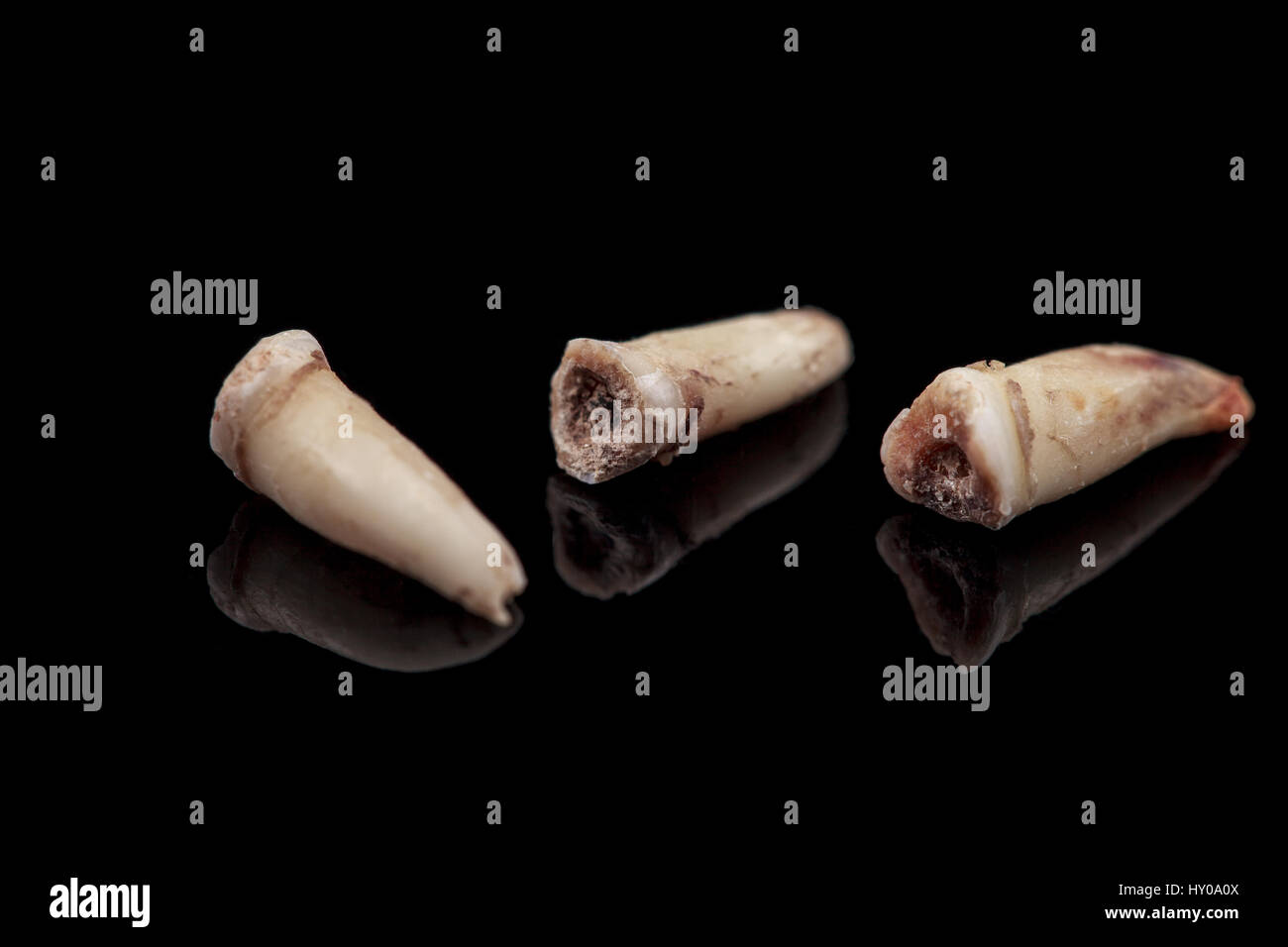 The removed teeth damaged by caries on a black background. Close-up ...