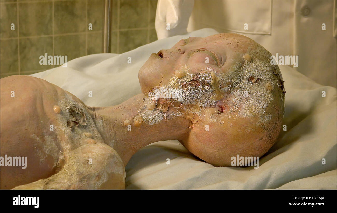 Alien body on gurney being examined after it's spaceship crashed near Roswell. A display at the International UFO Museum and Research Center in Rowsel Stock Photo