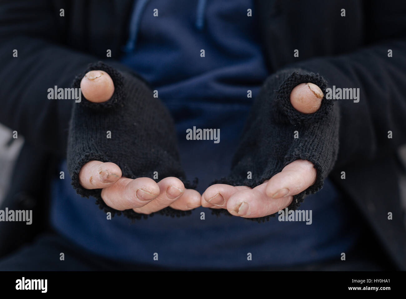 Sore hands hires stock photography and images Alamy