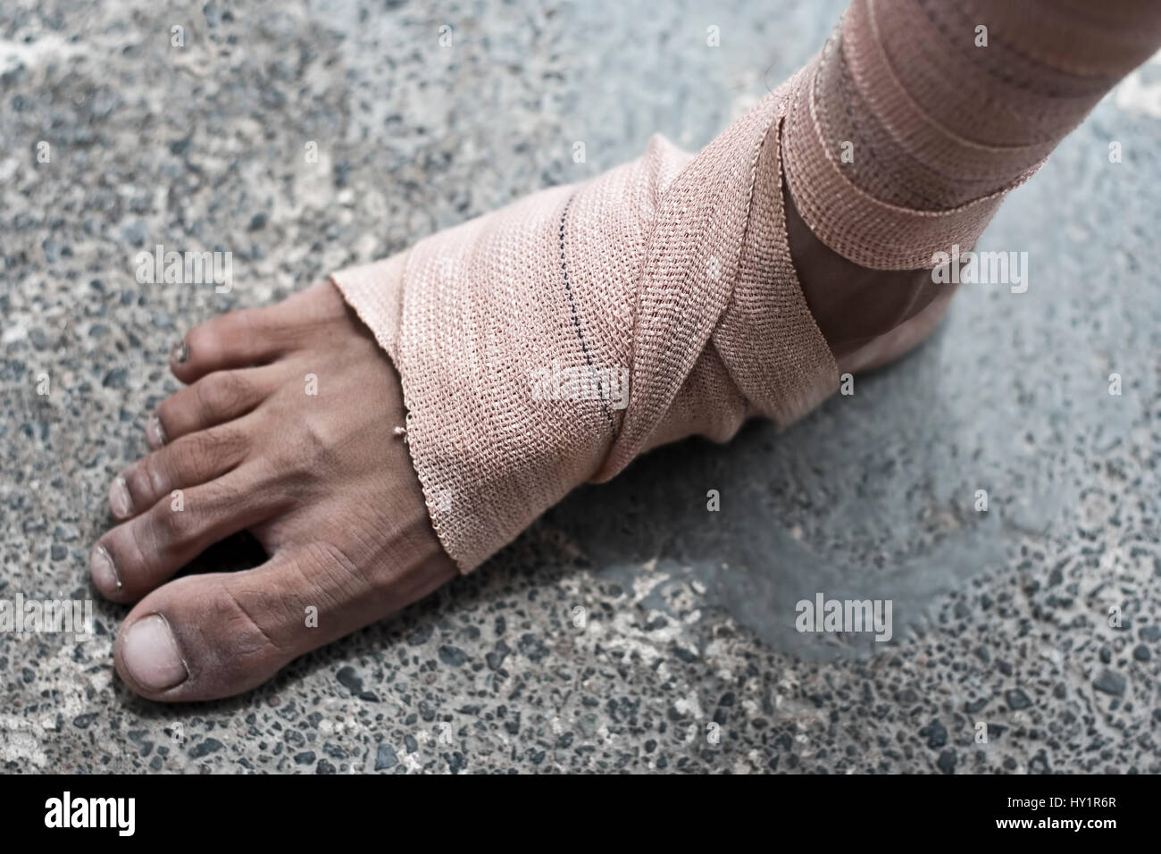 Human leg covered with a bandage or plaster Stock Photo - Alamy