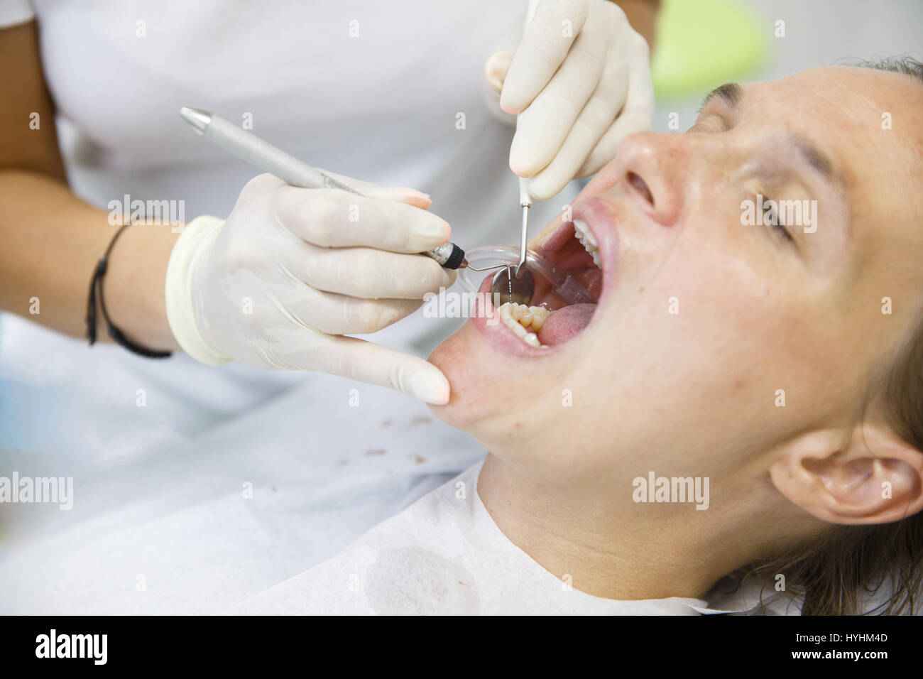 Patient getting her gum pocket depth measured with periodontal probe, held by dental hygienist, examining progression of periodontal disease. Dental h Stock Photo