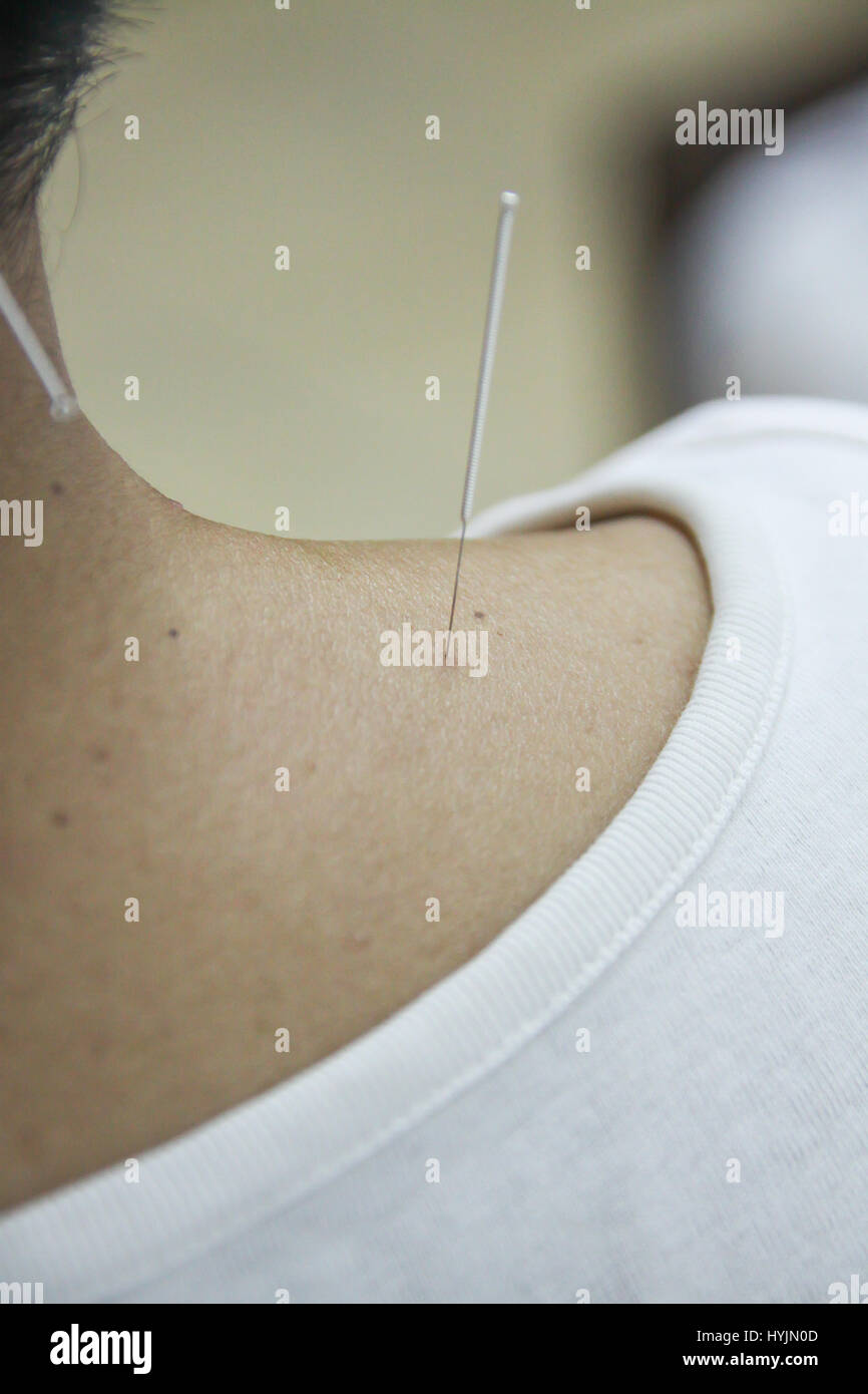 Acupuncture points hires stock photography and images Alamy