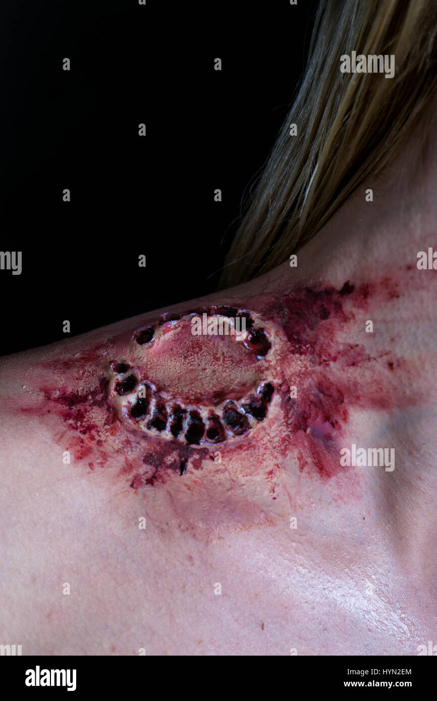 Fresh bloody bite from a zombie or monster on a shoulder of blonde woman. Scarry scene. Stock Photo