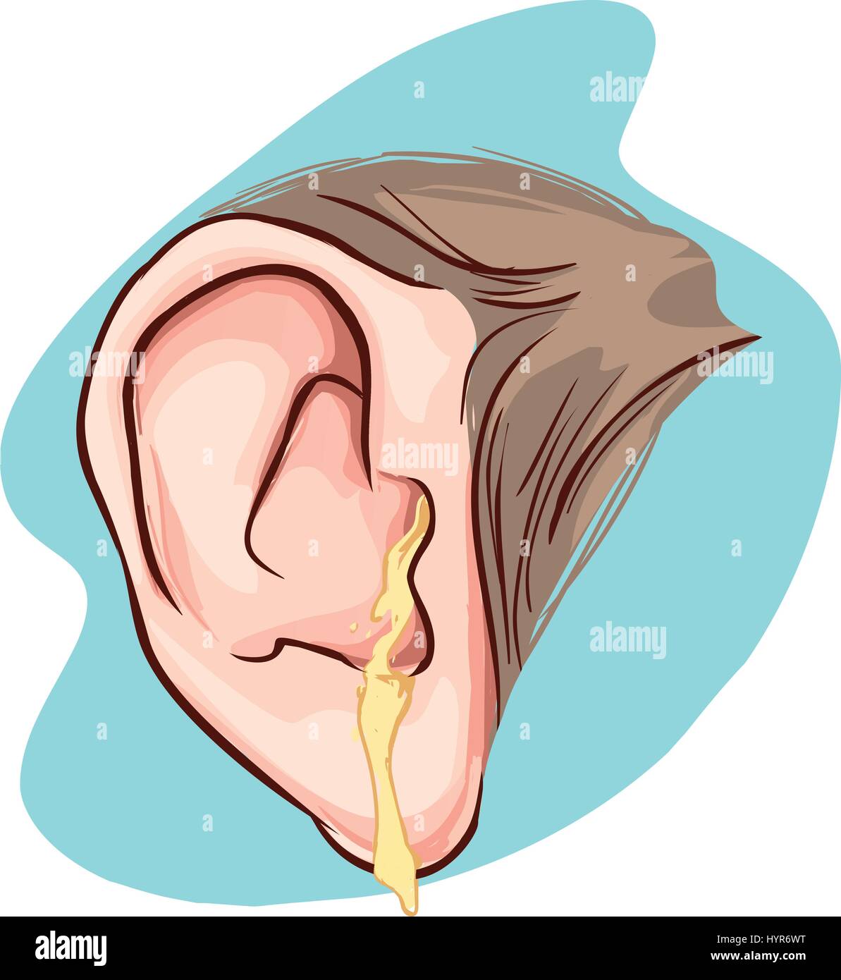 Ear Drainage