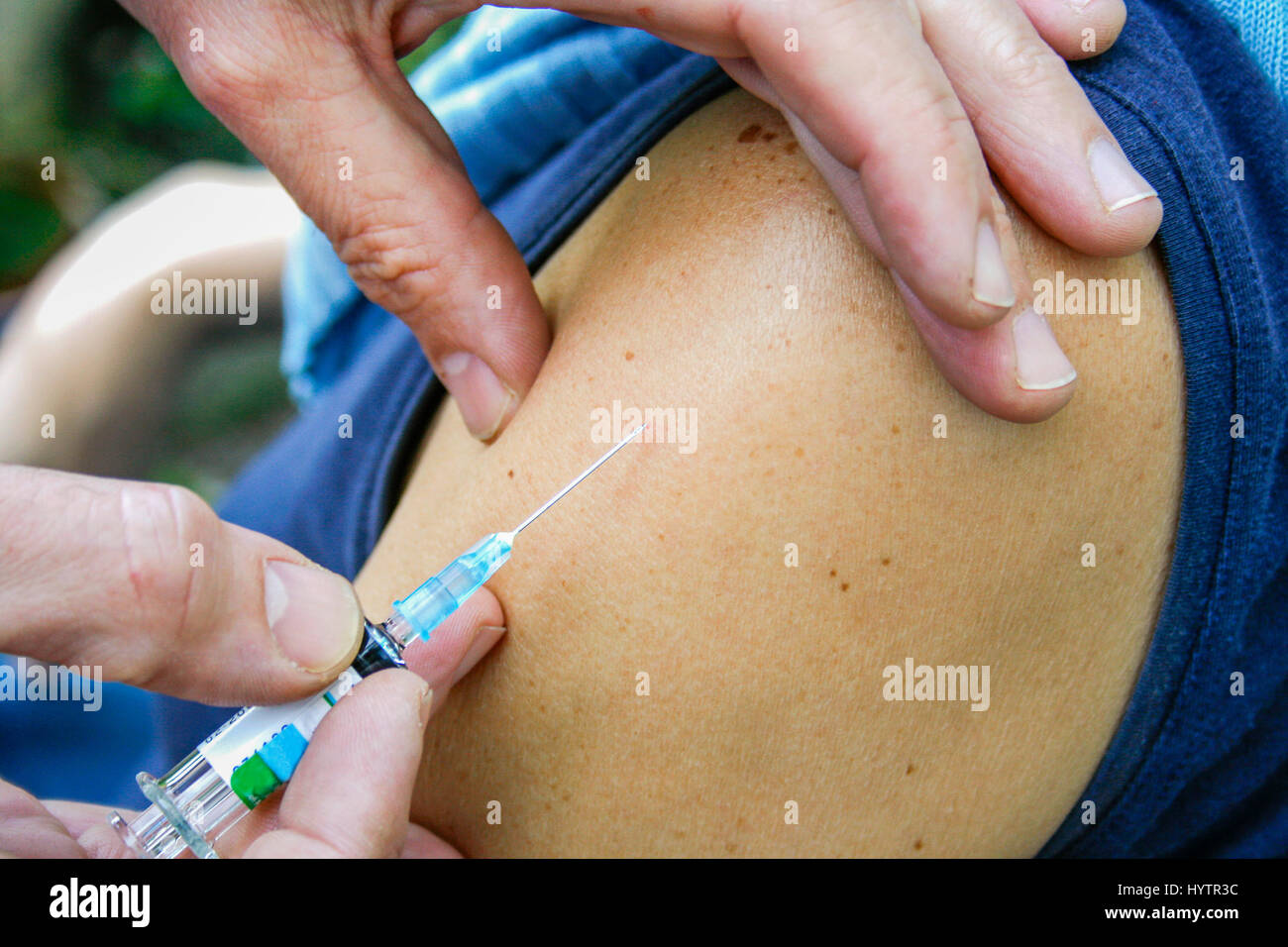 Doctor takes syringe out of arm after injection Stock Photo
