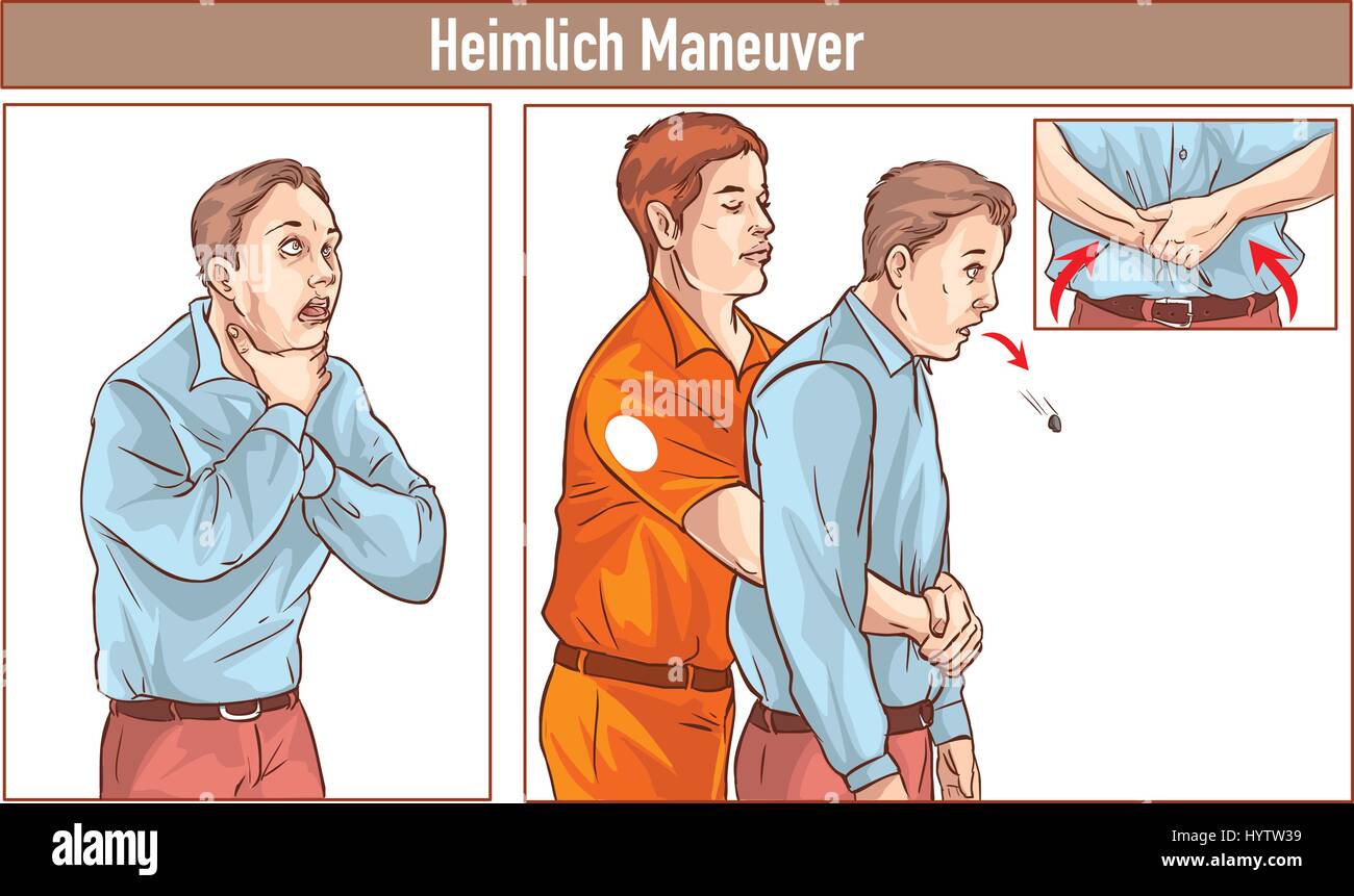 Clip Art of One man stands behind the conscious victim with his hands in the proper position on the victim's abdomen to perform the Heimlich maneuver Stock Vector