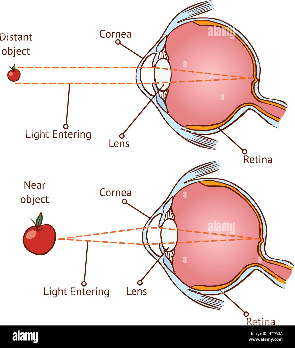 Myopia and normal vision ( color vector illustration ) Stock Vector