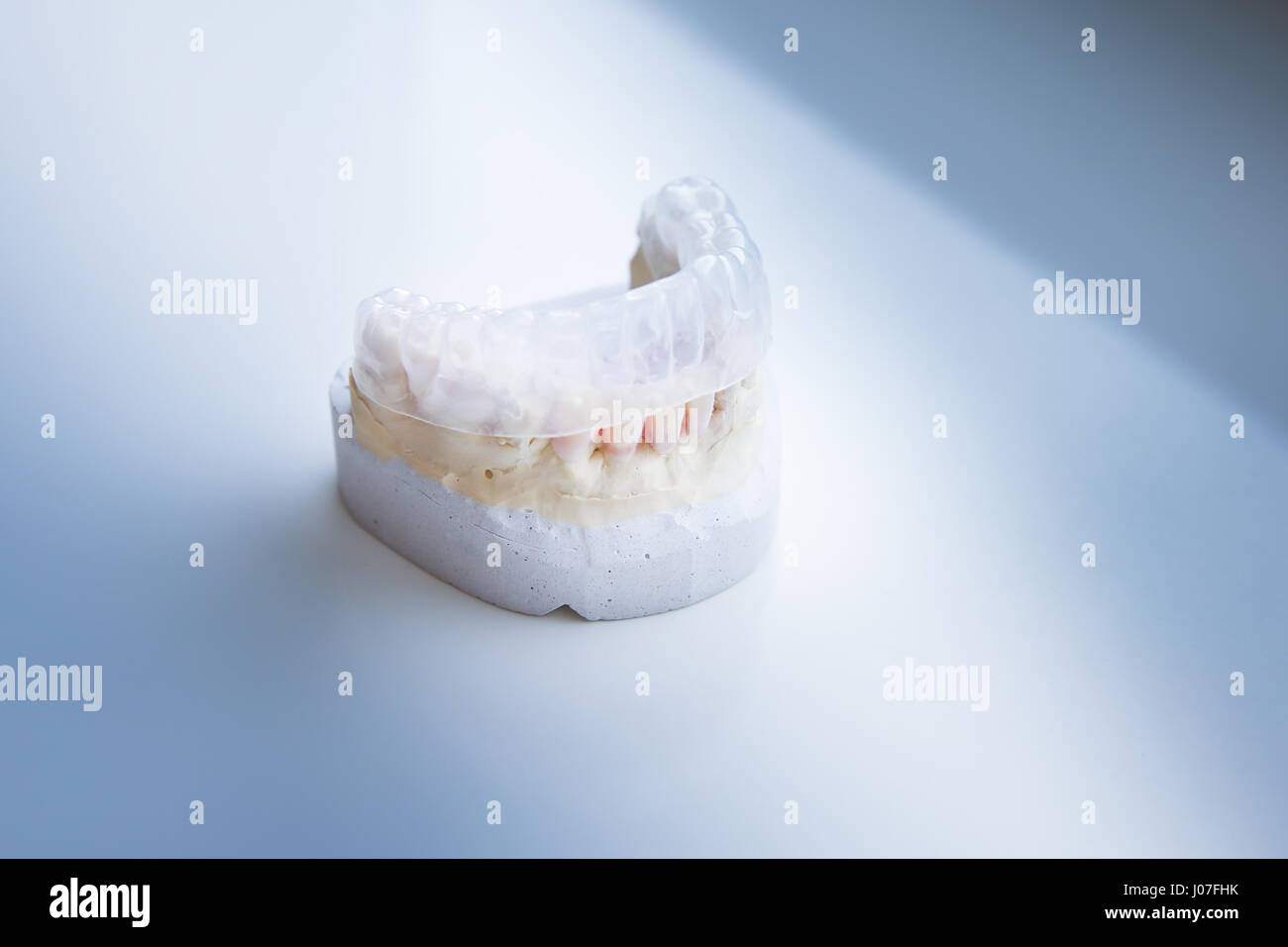 Invisalign, invisible plastic teeth aligner on a dental plaster mold Stock Photo