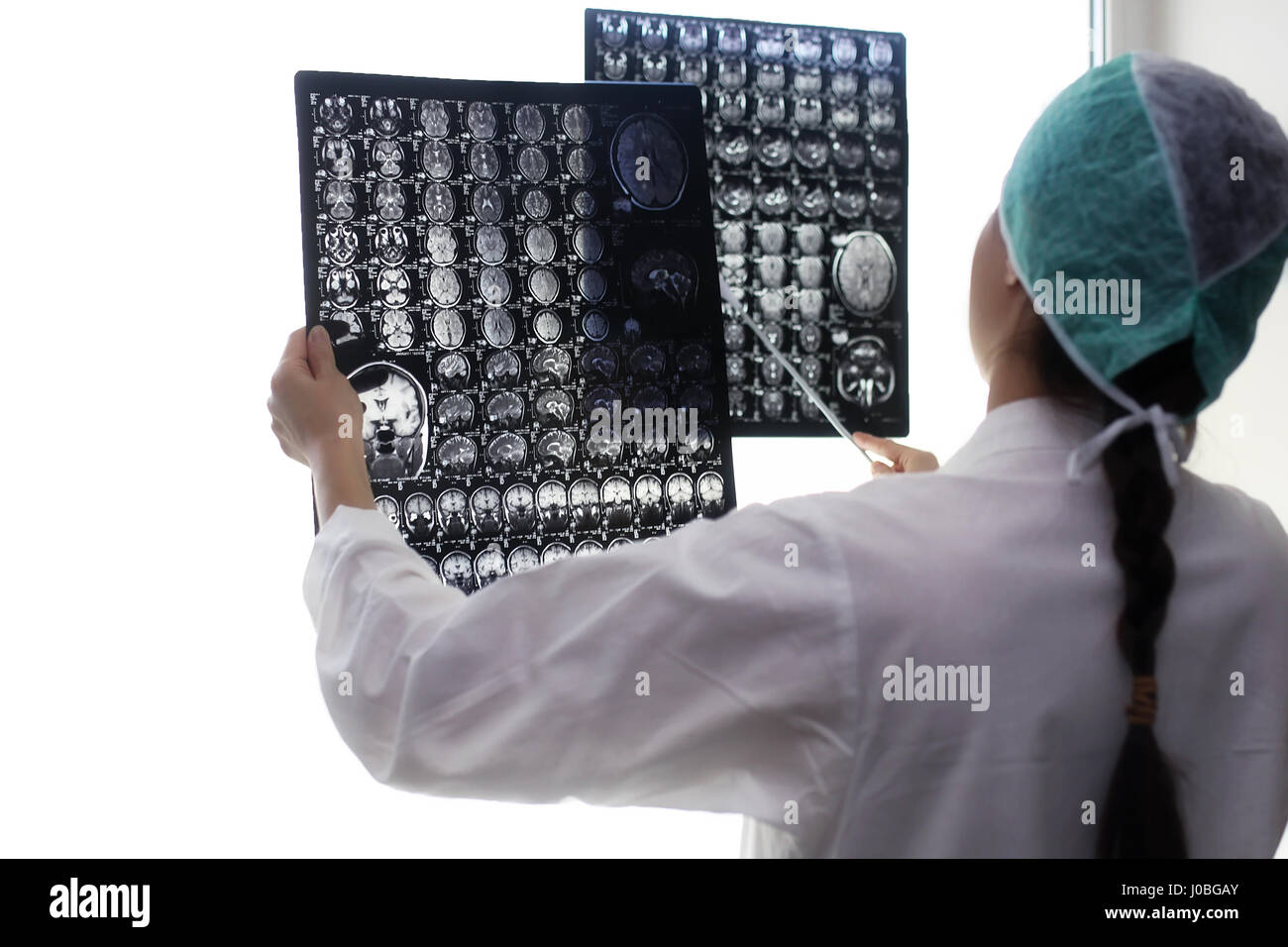 Doctor holding a picture of a brain MRI Stock Photo - Alamy
