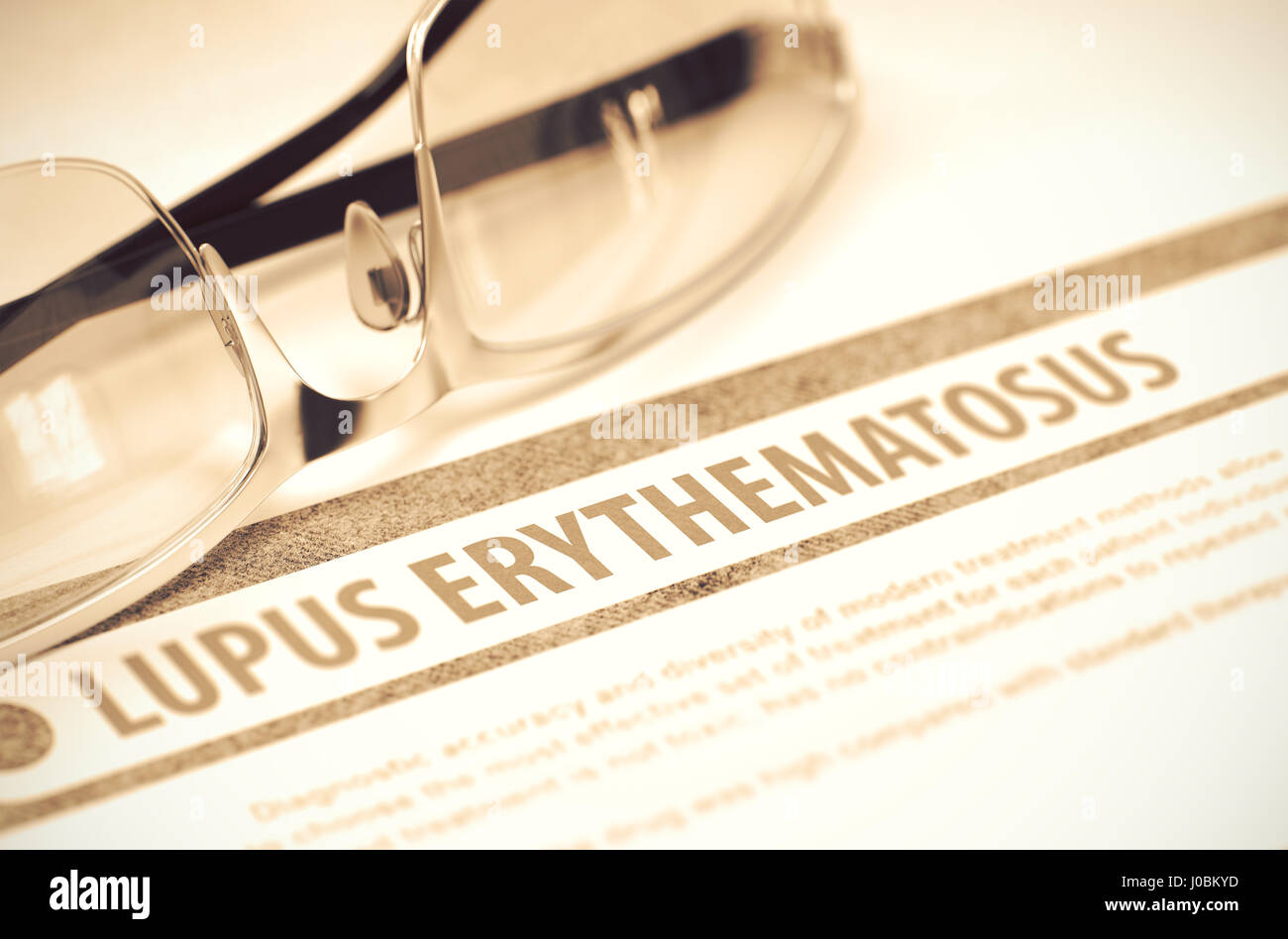 Lupus Erythematosus. Medicine. 3D Illustration. Stock Photo