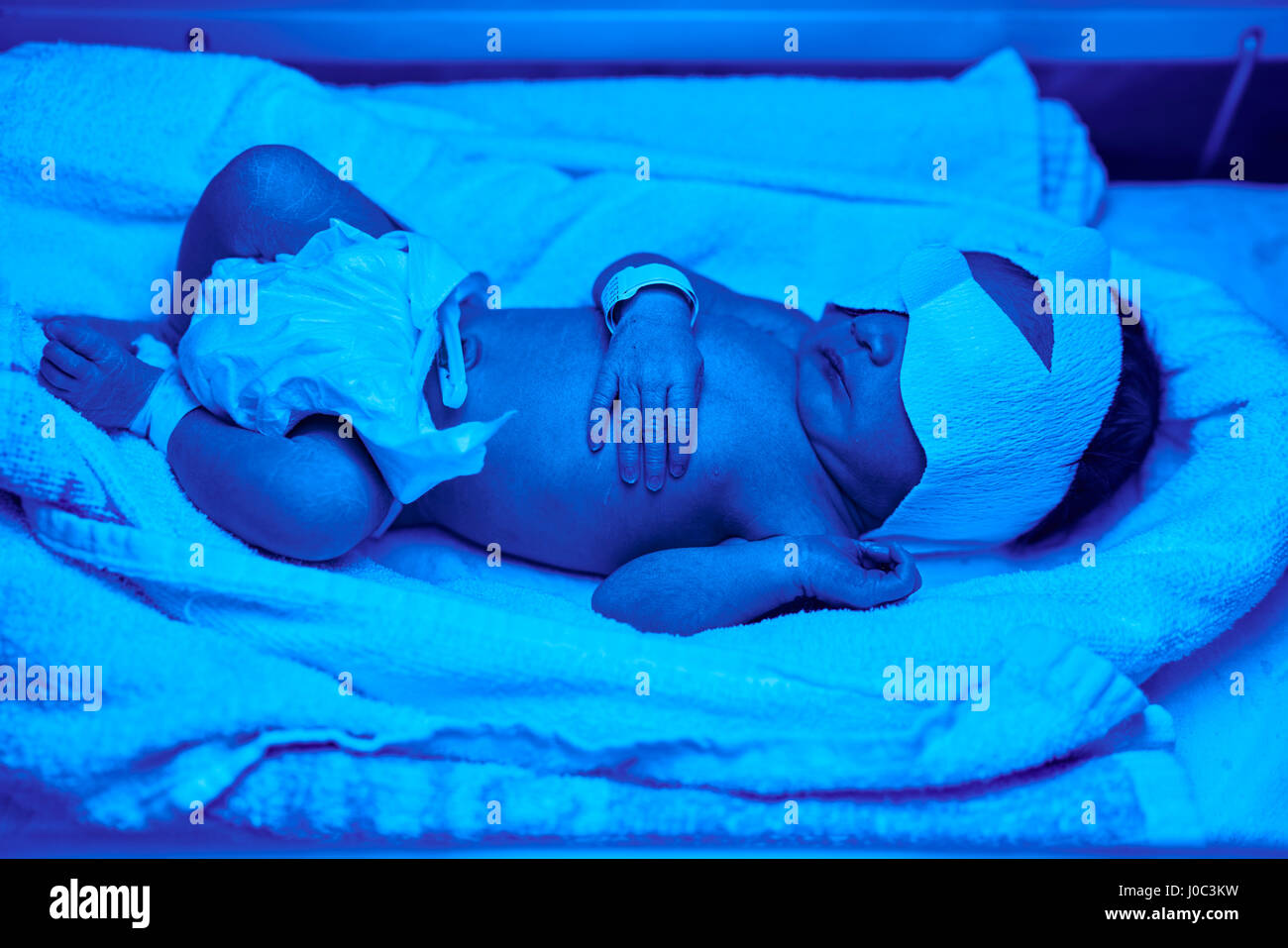 Blue light treatment for baby with jaundice Stock Photo