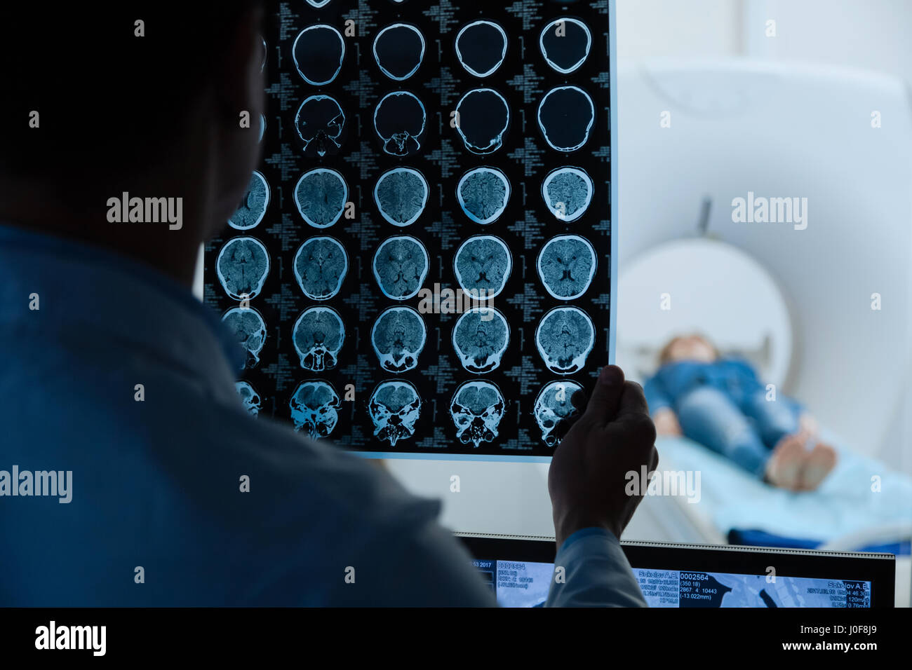 MRI scan images being examined by a doctor Stock Photo