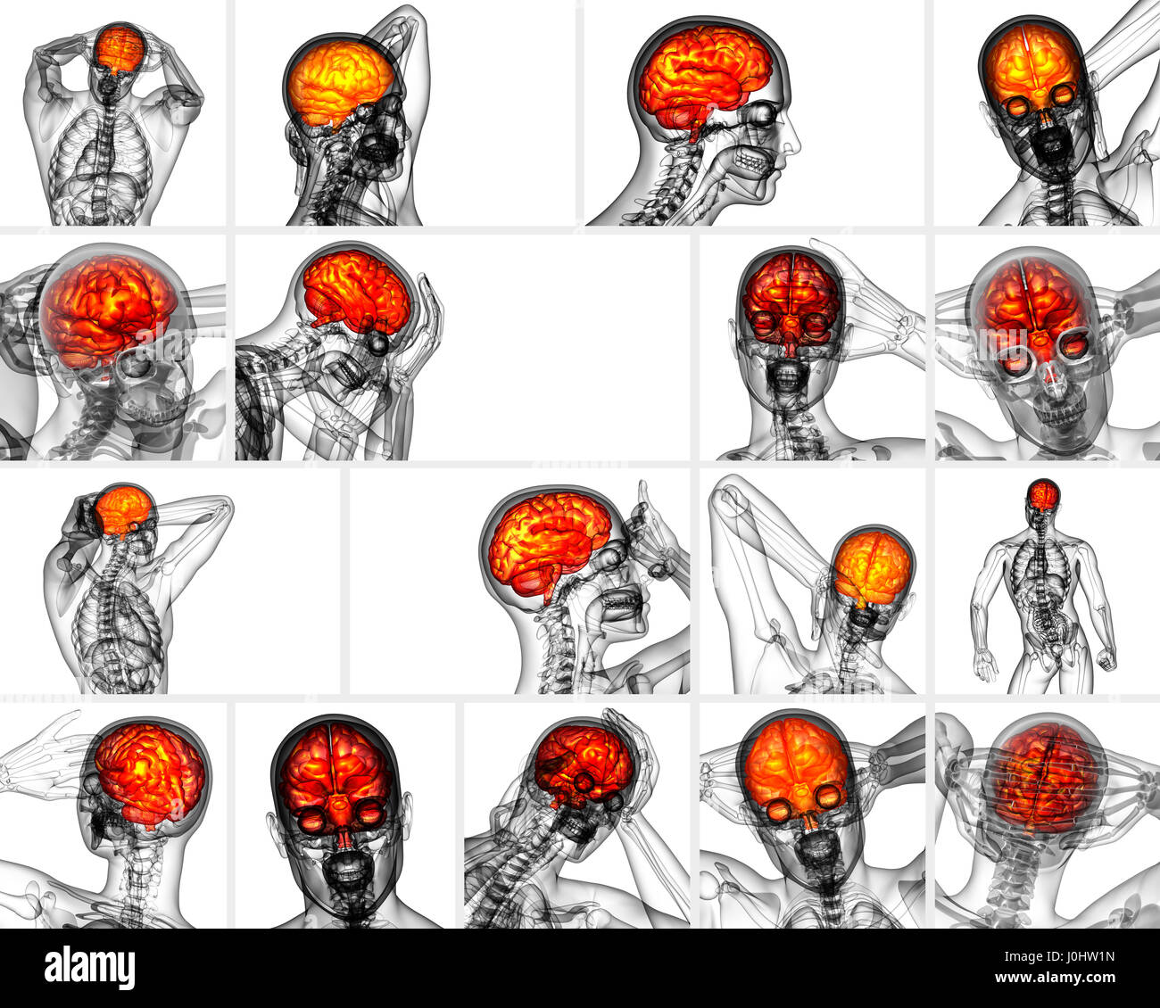 3d rendering medical illustration of the brain Stock Photo - Alamy