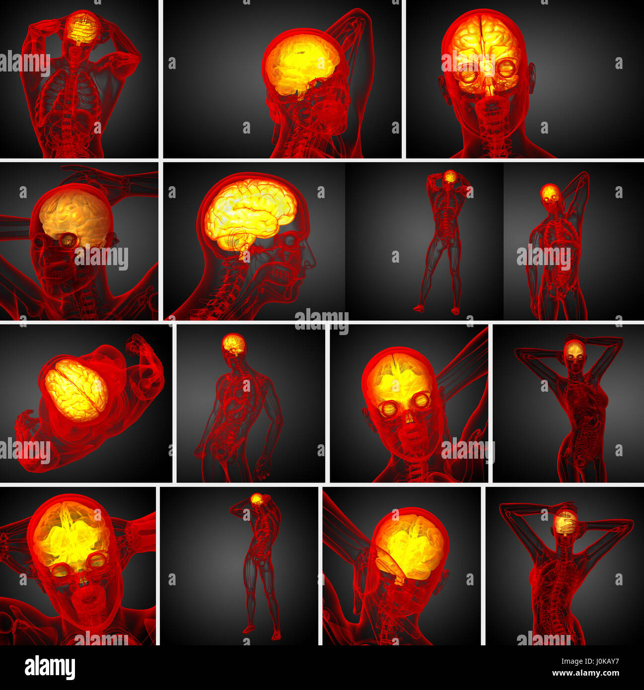 3d rendering medical illustration of the brain Stock Photo - Alamy
