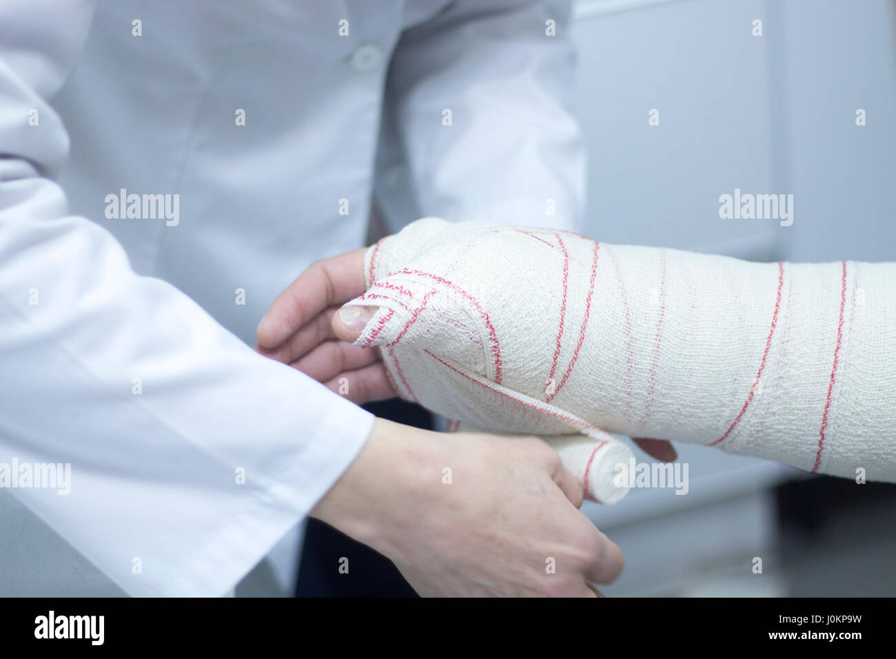 Doctor applying a plaster cast and bandages to patient forearm and wrist to immobilize after