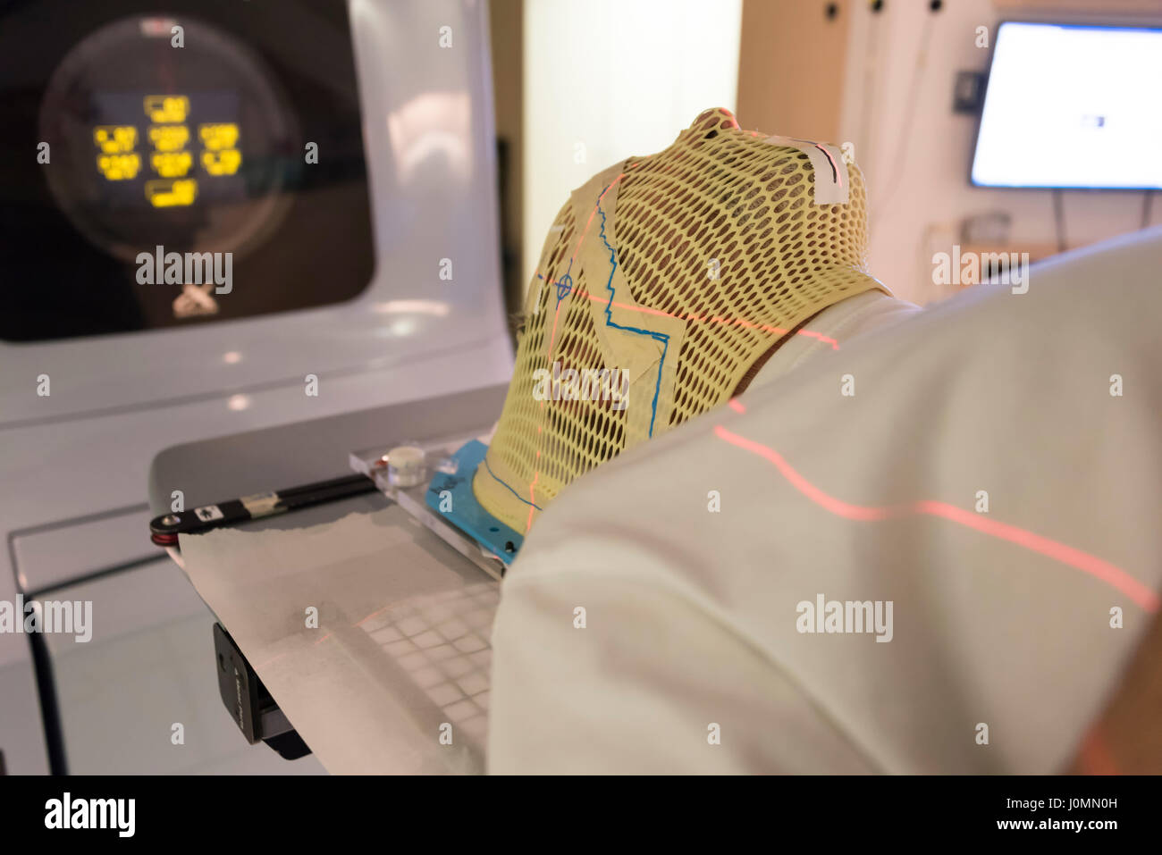 Download Radiotherapy Mask High Resolution Stock Photography And Images Alamy PSD Mockup Templates