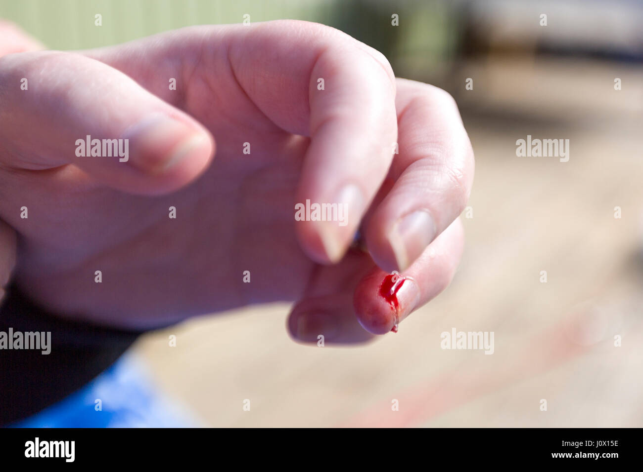typing fingers bleeding typing fingers bleeding