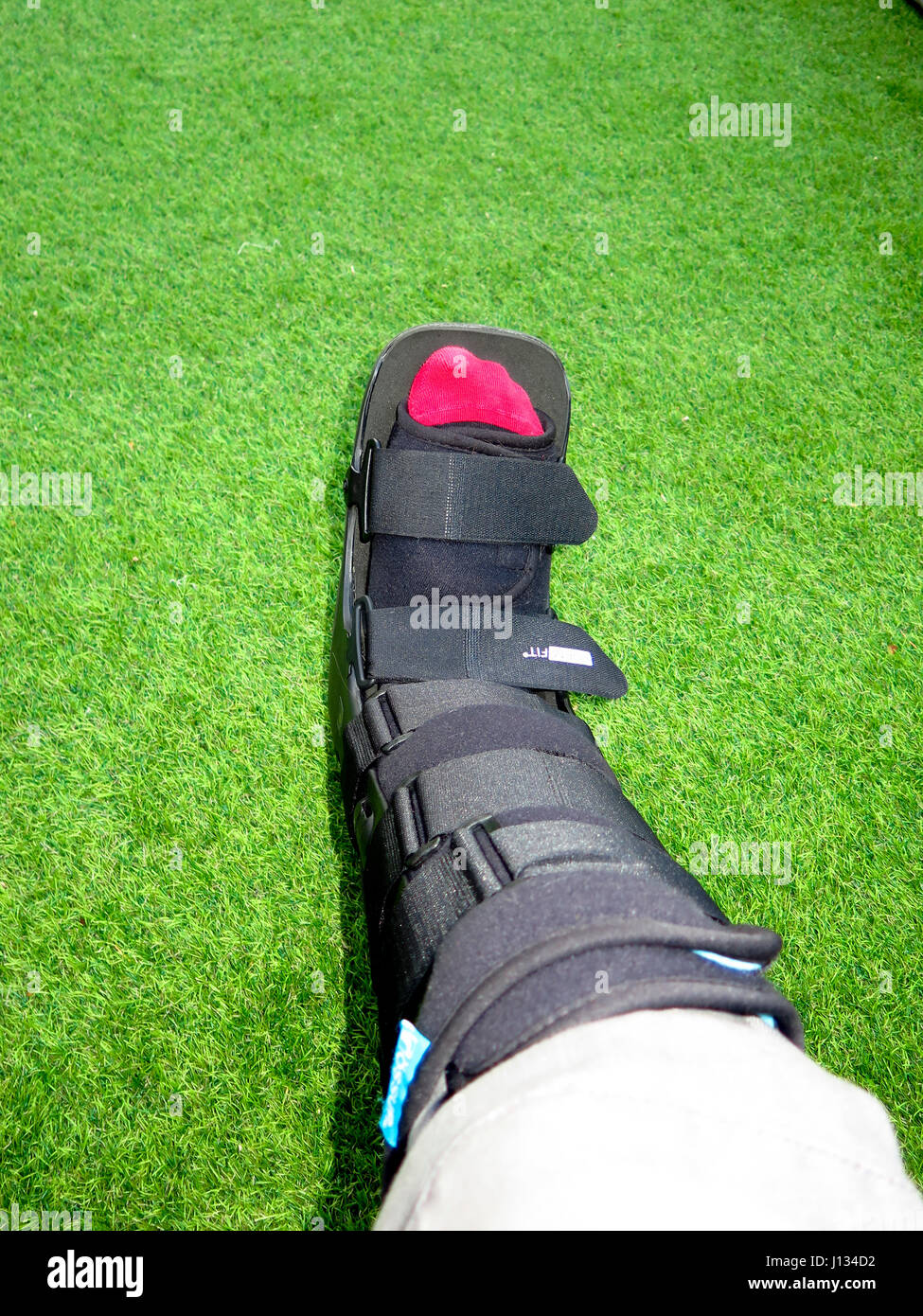 Medical support boot for broken ankle Stock Photo Alamy