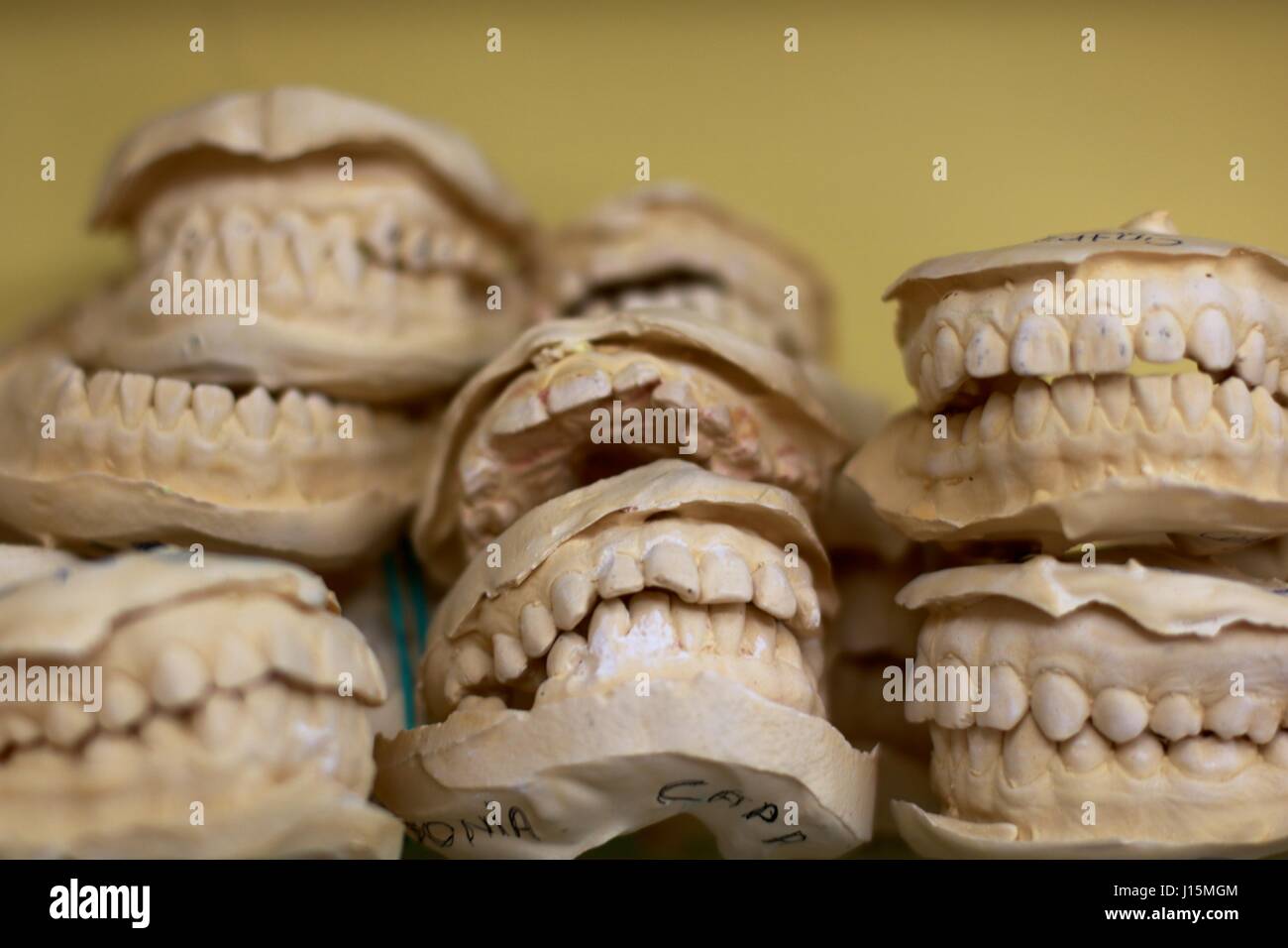 Impression Mold Teeth mold hi-res stock photography and images - Alamy