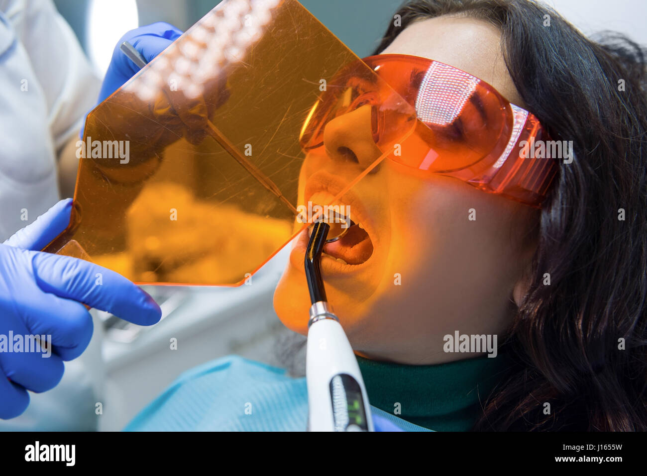Female patient at the dentist. Concave mirror and curing light Stock