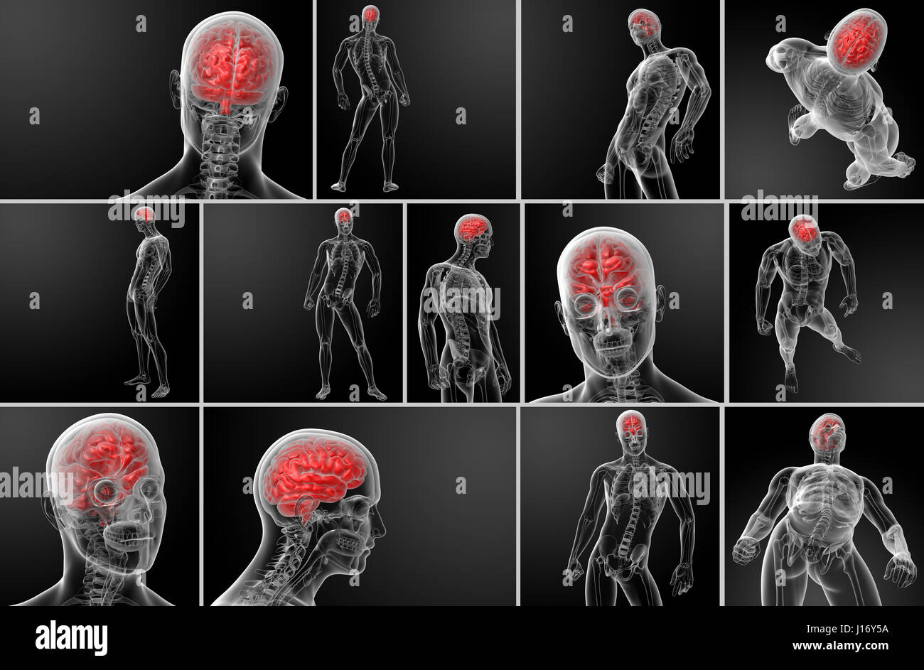 3d rendering human brain X ray Stock Photo