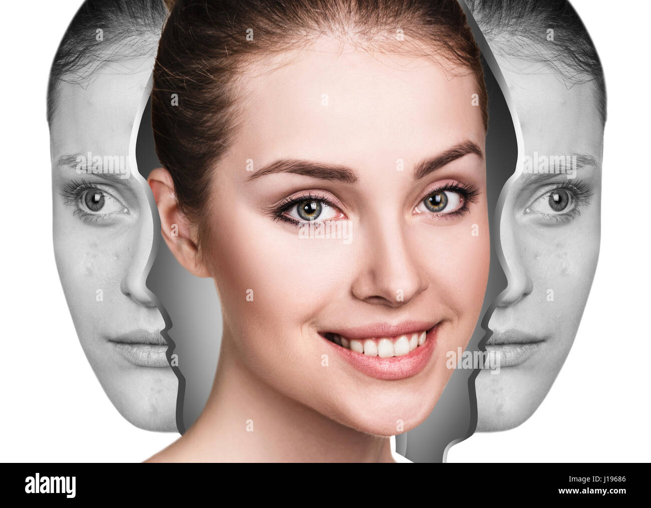 Woman rebirth from bad acne skin to perfect. Stock Photo