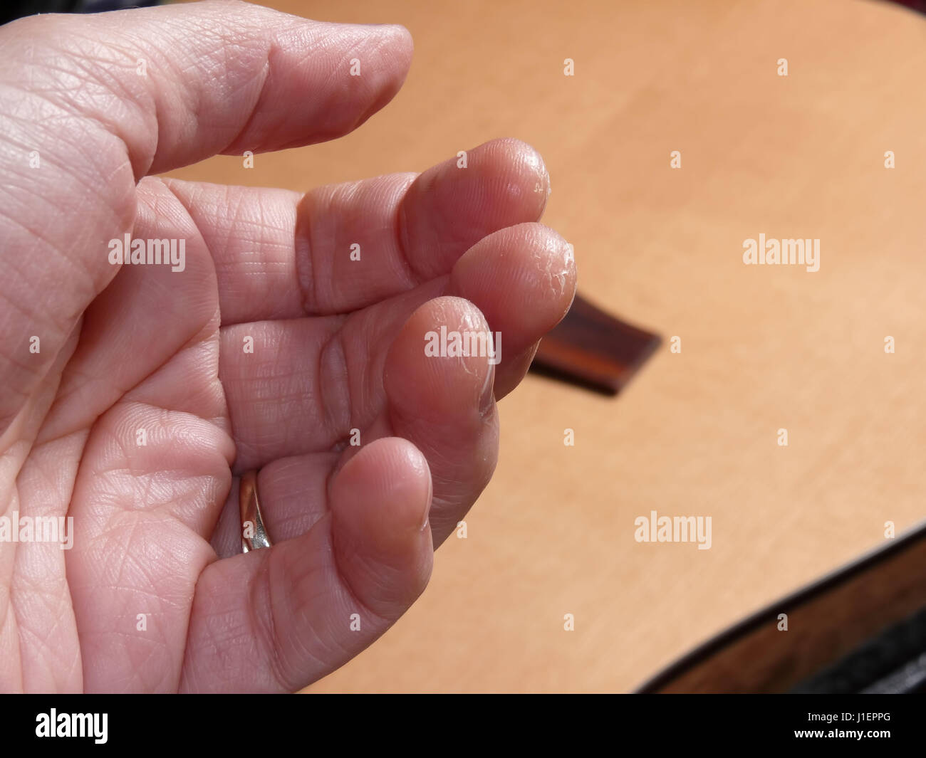 Close up of a woman's fingers rubbed raw from playing the guitar. Stock Photo