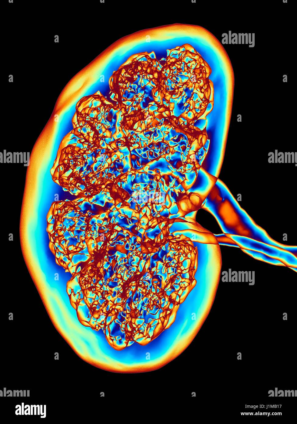 Kidney, CT scan. False colour 3-D computed tomography (CT) scan of a kidney in frontal view. Stock Photo