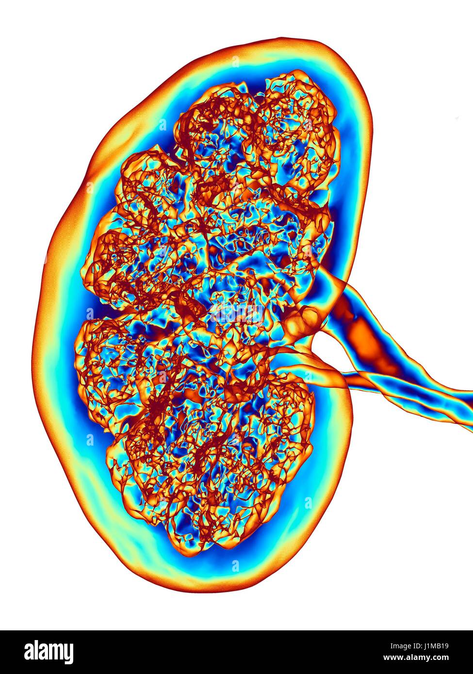 Kidney, CT scan. False colour 3-D computed tomography (CT) scan of a kidney in frontal view. Stock Photo