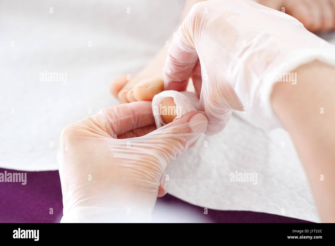 Dressing on the toe. Podology, putting gauze dressings on big toe Stock