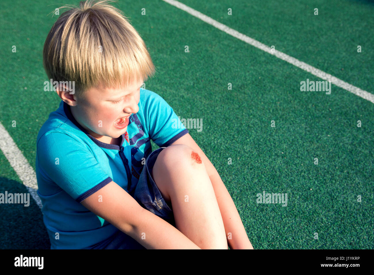 Boy with a scraped knee outdoor. Wound on boy knee after accident. Stock Photo