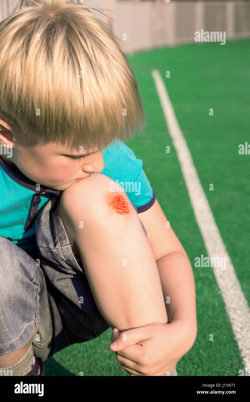 Boy with a scraped knee outdoor. Wound on boy knee after accident. Stock Photo