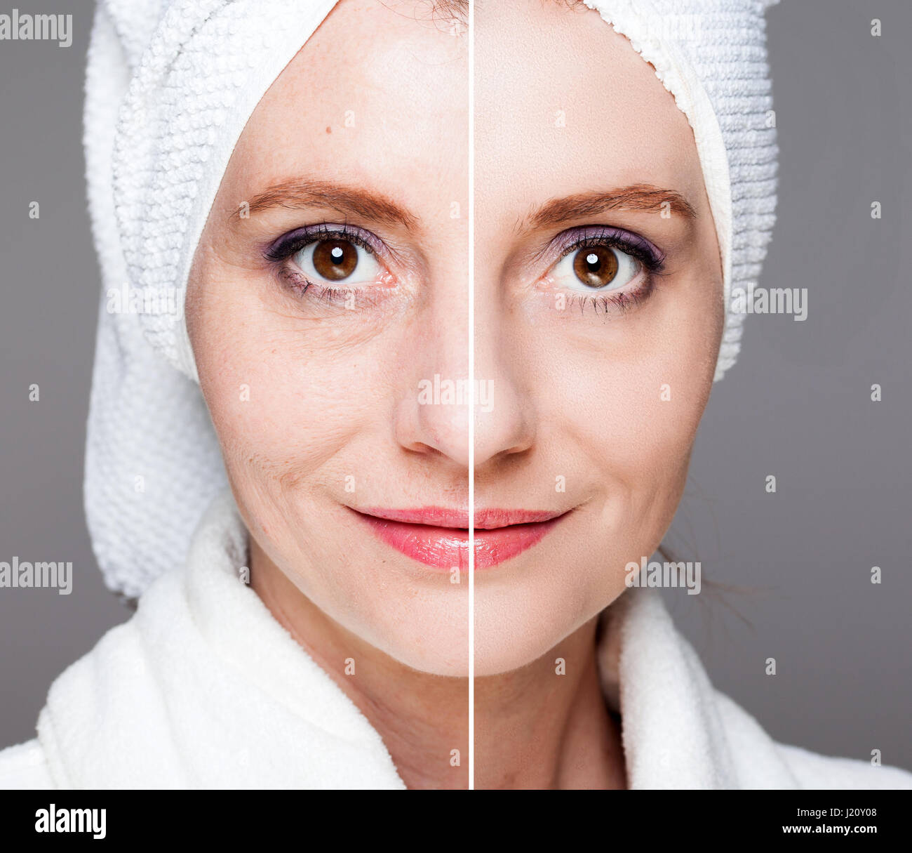 How to Care for the Skin After Laser Hair Removal picture photo How to Care for the Skin After Laser Hair Removal